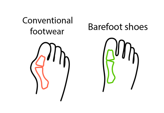 What are barefoot shoes?