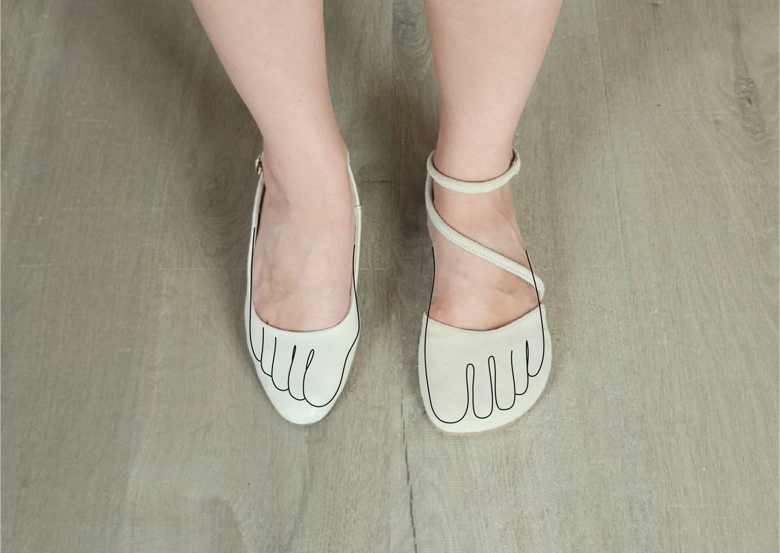 Ball of Foot Calluses: Can Barefoot Shoes Help?