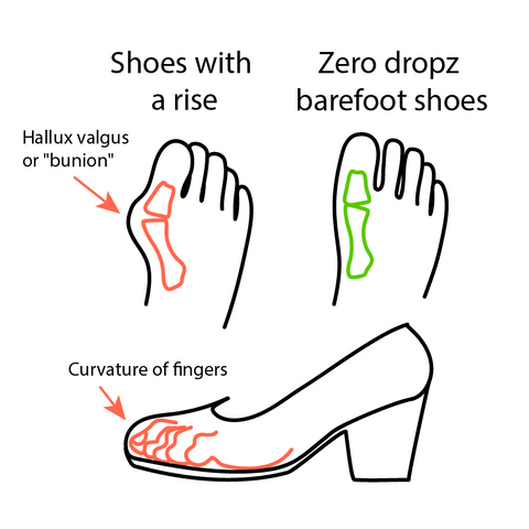 How Even a Small Heel Affects Your Health
